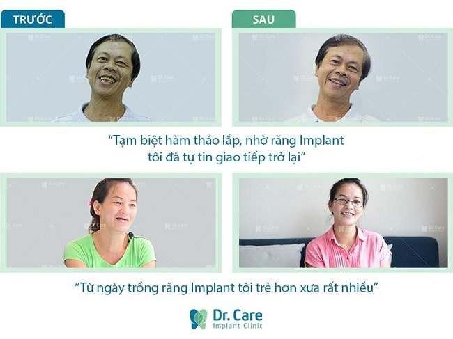 Hình ảnh khách hàng trước và sau khi sự dụng dịch vụ tại DrCare