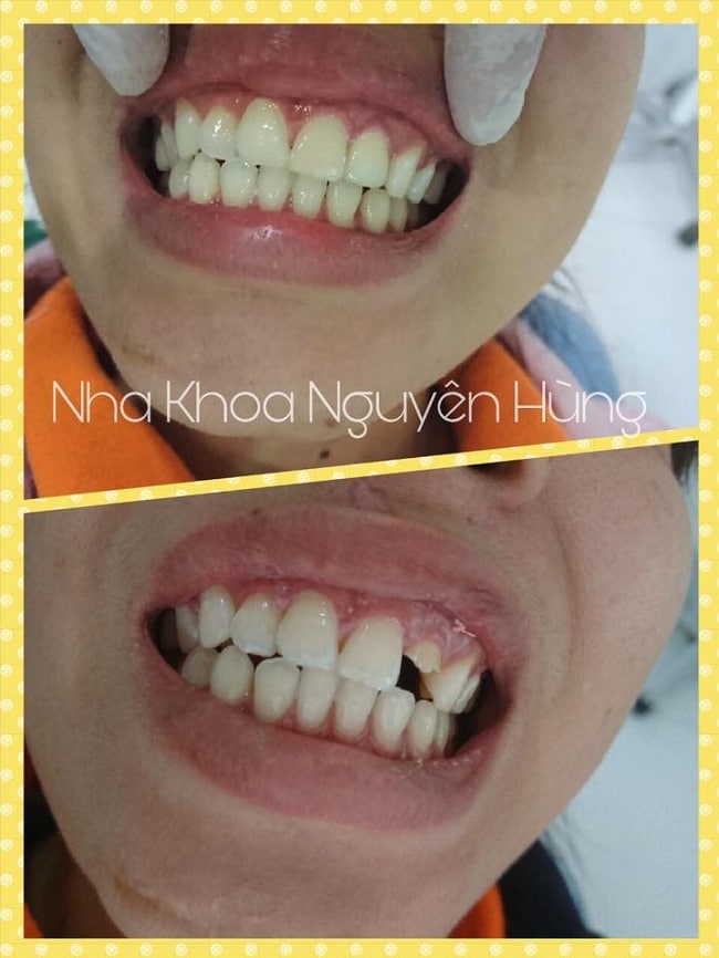 nha-khoa