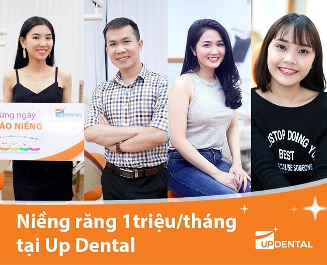 Khách hàng niềng răng tại Up Dental