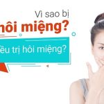 hôi miệng