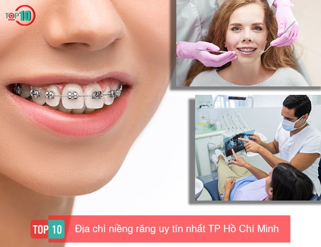 Top 10 địa chỉ niềng răng ở TPHCM tốt và uy tín nhất 2024