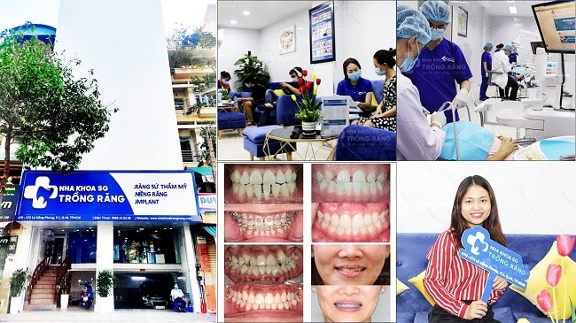 Nha khoa niềng răng uy tín