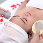 Hút chì da mặt là gì?