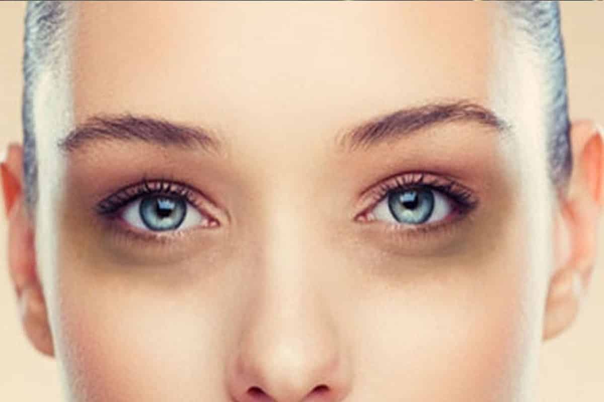 10 cách xóa thâm quầng mắt nhanh, an toàn, dễ thực hiện tại nhà