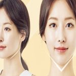 địa chỉ tiêm filler cằm ở TPHCM