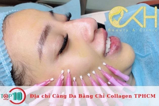 Spa căng da mặt bằng chỉ collagen tại TPHCM| Nguồn: CKH Beauty & Clinic (Chu Khả Hiếu)