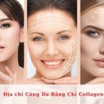 Top địa chỉ Căng Da Bằng Chỉ Collagen TPHCM tốt nhất