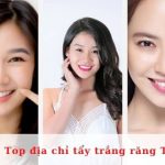 Top địa chỉ tẩy trắng răng TPHCM tốt nhất