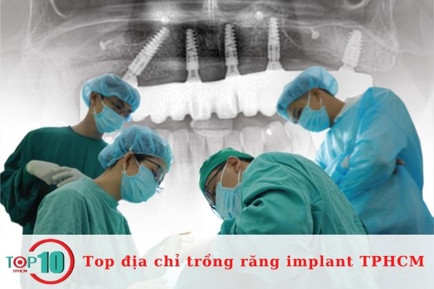Cơ sở trồng răng implant ở TPHCM uy tín| Nguồn: Dr.Care Implant