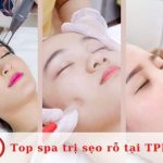 Top 10 spa trị sẹo rỗ an toàn và chất lượng nhất tại TPHCM