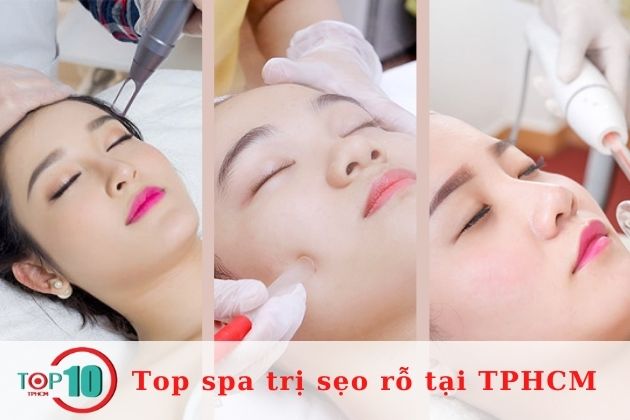 Top 10 spa trị sẹo rỗ an toàn và chất lượng nhất tại TPHCM