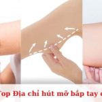 Top địa chỉ hút mỡ bắp tay ở TPHCM an toàn, uy tín nhất