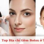 Top địa chỉ tiêm botox ở TPHCM đẹp, uy tín và an toàn nhất