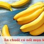 Ăn chuối có nổi mụn không? Thực phẩm nào khi ăn dễ gây nổi mụn?
