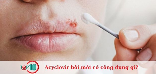  Cách bôi Acyclovir sau phun môi đúng