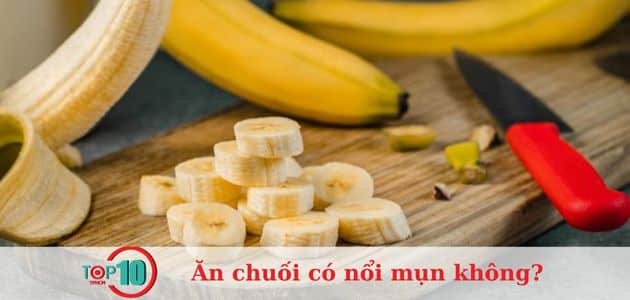 Kiểm soát đường huyết