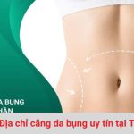 Các địa chỉ căng da bung uy tín ở TPHCM
