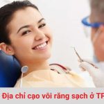Các địa chỉ cạo vôi răng ở TPHCM sạch và uy tín
