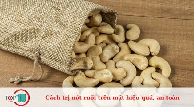 Trị nốt ruồi ở mặt bằng hạt điều 