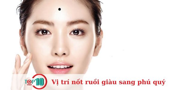 Nốt ruồi mọc ở trán