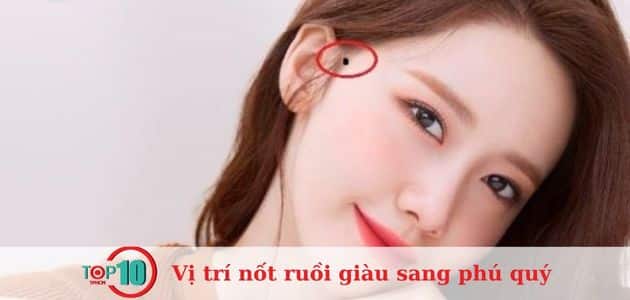 nốt ruồi mọc trong tóc