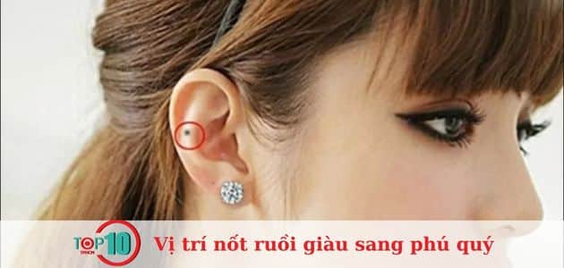 Nốt ruồi nằm trên tai phải