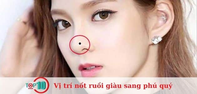 Nốt ruồi xuất hiện ở mũi