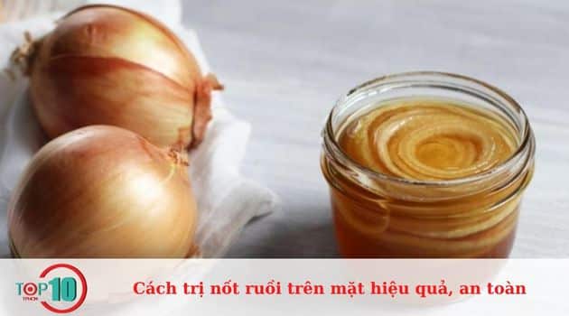 Nước ép hành tây trị nốt ruồi 