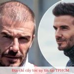 Địa chỉ cấy tóc