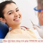Làm răng trả góp TPHCM