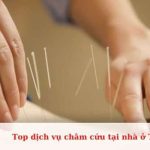 Top dịch vụ châm cứu tại nhà tốt và uy tín ở TPHCM