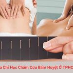 Địa Chỉ Học Châm Cứu Bấm Huyệt Ở TPHCM Uy Tín