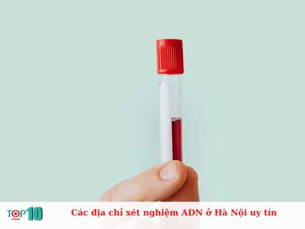 Các địa chỉ xét nghiệm ADN ở Hà Nội uy tín