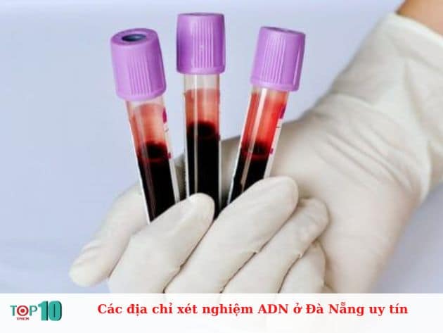 Các địa chỉ xét nghiệm ADN ở Đà Nẵng uy tín