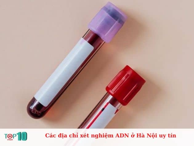 Các địa chỉ xét nghiệm ADN ở Hà Nội uy tín