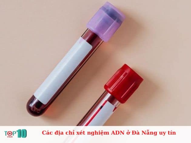 Các địa chỉ xét nghiệm ADN ở Đà Nẵng uy tín