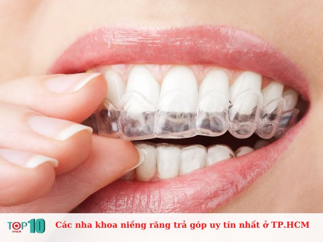  Các nha khoa niềng răng trả góp uy tín nhất ở TP.HCM