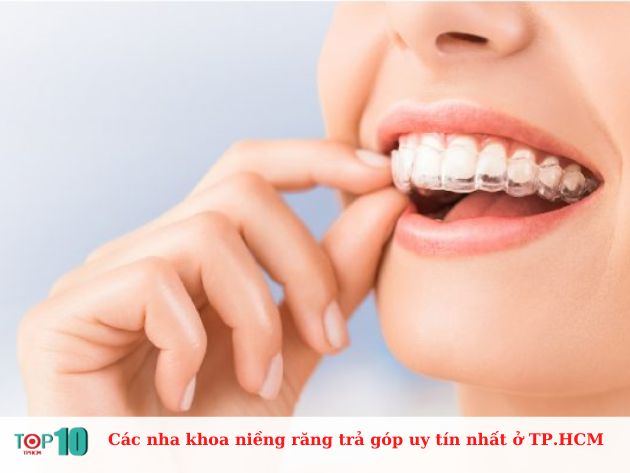  Các nha khoa niềng răng trả góp uy tín nhất ở TP.HCM