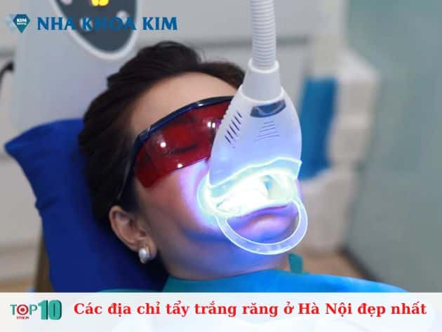 Các địa chỉ tẩy trắng răng ở Hà Nội đẹp nhất