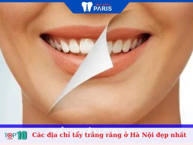 Các địa chỉ tẩy trắng răng ở Hà Nội đẹp nhất