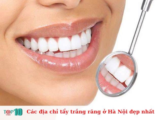 Các địa chỉ tẩy trắng răng ở Hà Nội đẹp nhất