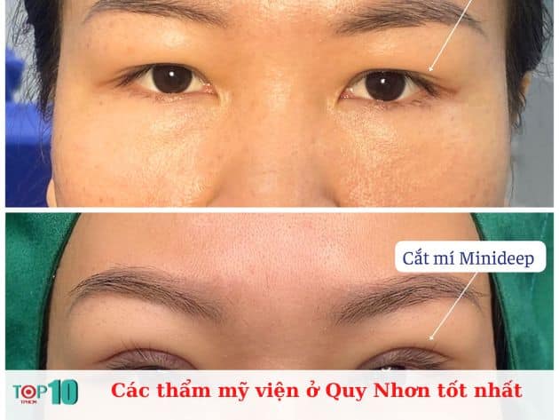  Các thẩm mỹ viện ở Quy Nhơn tốt nhất