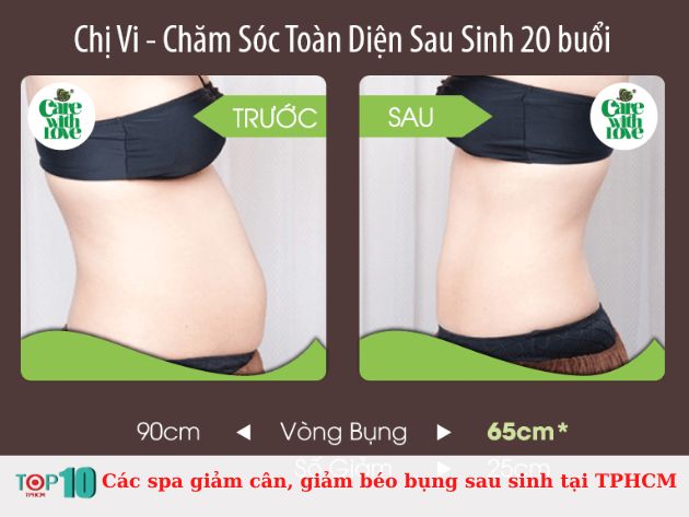 Các spa giảm cân, giảm béo bụng sau sinh tại TPHCM