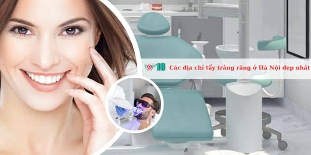 Các địa chỉ tẩy trắng răng ở Hà Nội đẹp nhất