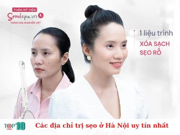 Các địa chỉ trị sẹo ở Hà Nội uy tín nhất