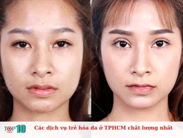 Các dịch vụ trẻ hóa da ở TPHCM chất lượng nhất