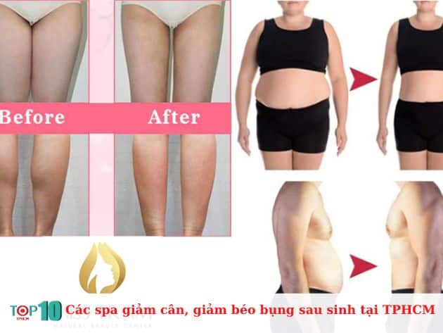 Các spa giảm cân, giảm béo bụng sau sinh tại TPHCM