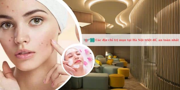 Top 11 thẩm mỹ viện, spa trị mụn ở Hà Nội uy tín, hiệu quả nhất