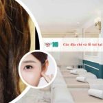 Các địa chỉ vá lỗ tai tại TPHCM đẹp & an toàn nhất
