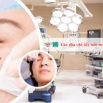 Các địa chỉ tẩy nốt ruồi tại TP.HCM uy tín nhất